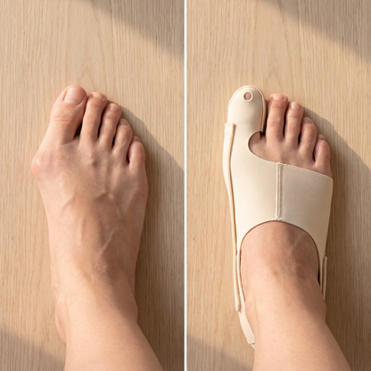 TrueToe™ Bunion Strap